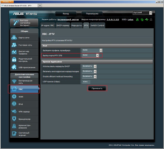 IPTV-SUS